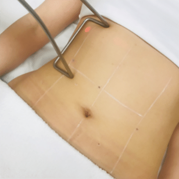 Generations - Tightsculpting