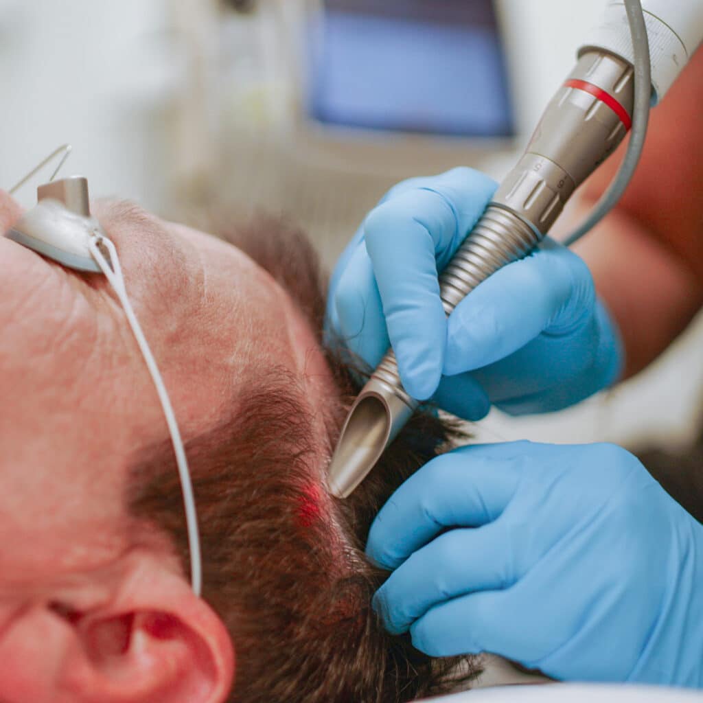Hair restoration treatment