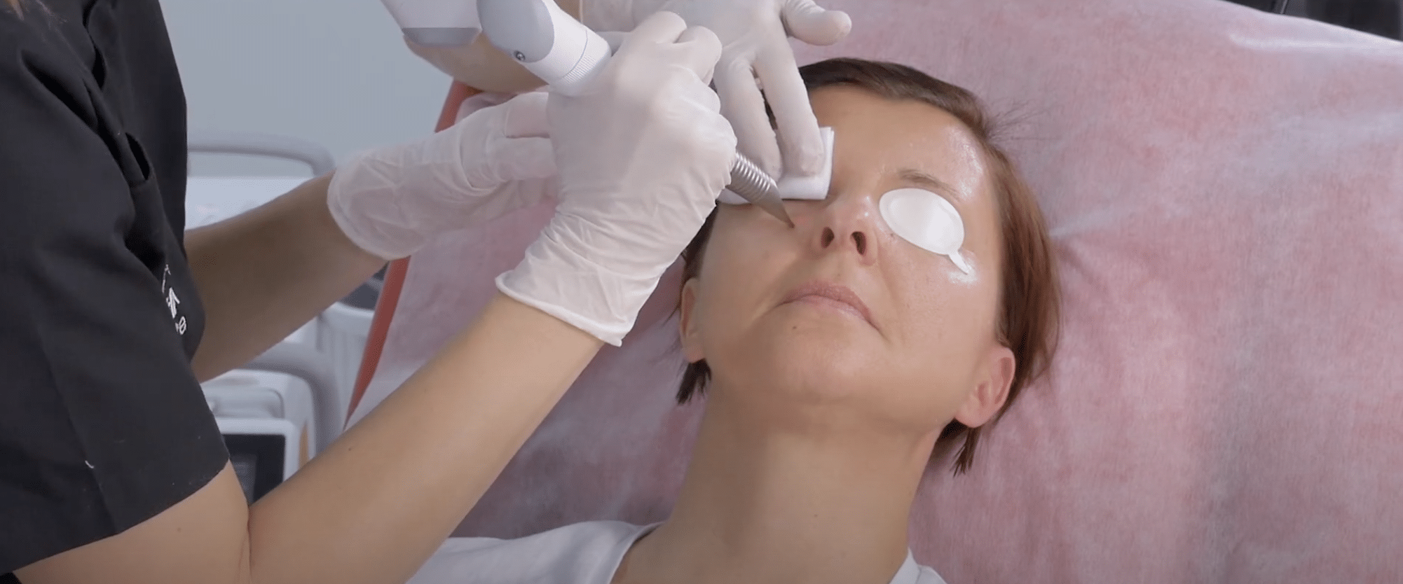 1772672521_Eye-rejuvenation-page-banner Woman getting eye rejuvenation treatment done